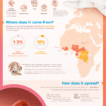 monkeypox-explainer-infographic
